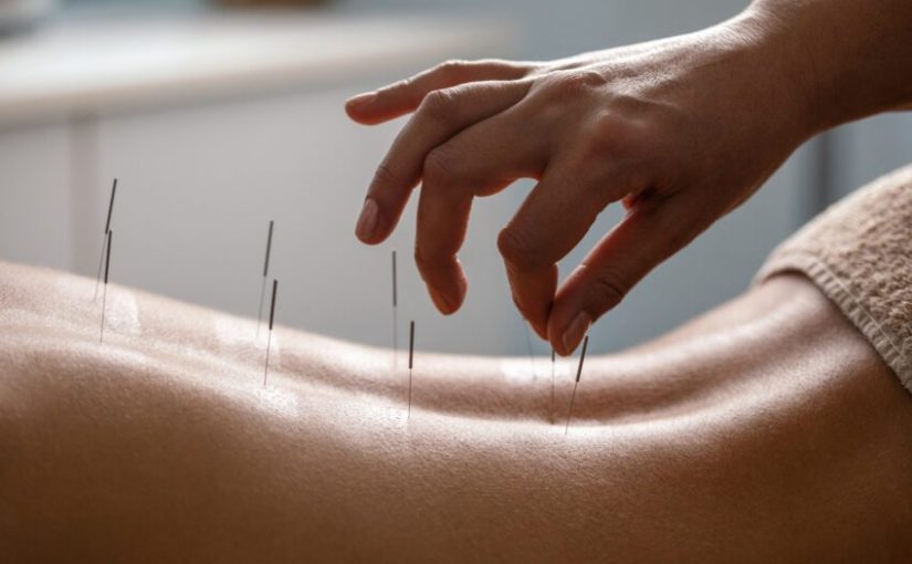 Acupuncture Therapy Guide: Top Tips For A Successful Treatment